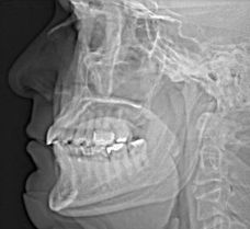 Bild "Patienteninfo:dvt.jpg"