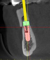 Bild "Patienteninfo:dvt2.jpg"