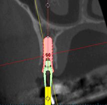 Bild "Patienteninfo:dvt3.jpg"
